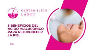 5 Beneficios del Acido Hialuronico para Rejuvenecer la Piel