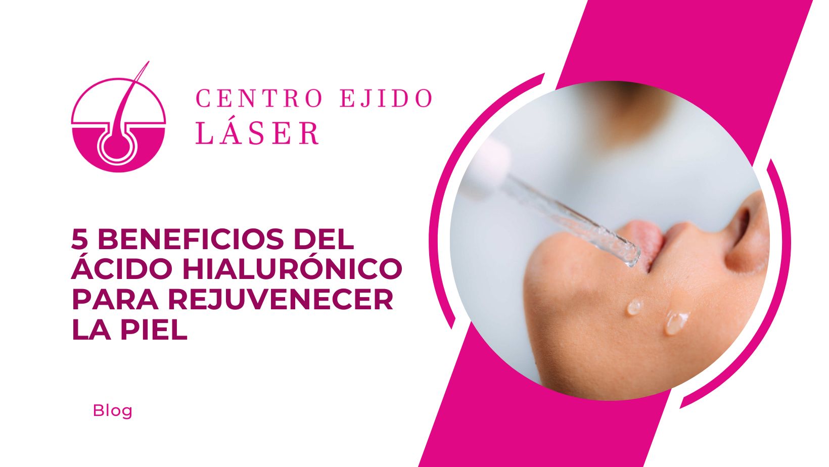 5 Beneficios del Acido Hialuronico para Rejuvenecer la Piel