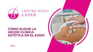 Cómo elegir la mejor clínica estética en El Ejido