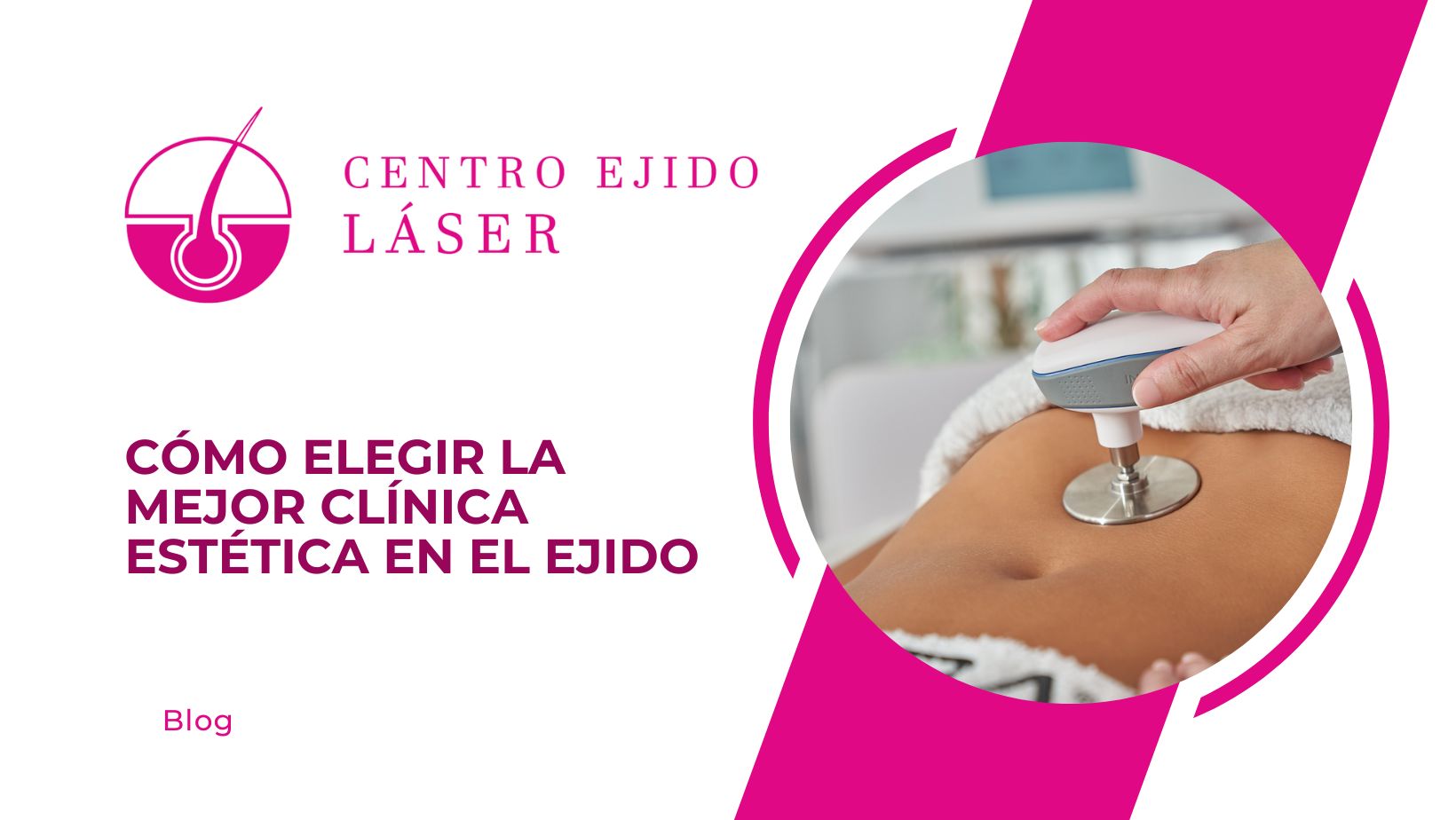 Cómo elegir la mejor clínica estética en El Ejido