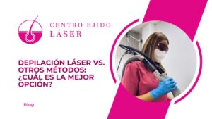 Depilación láser vs. otros métodos ¿Cuál es la mejor opción